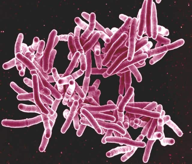 How Does the New Coronavirus Affect the People with Tuberculosis And HIV?