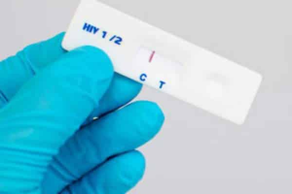 HIV test